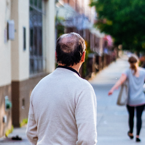 The Most Common Reasons for Hair Loss